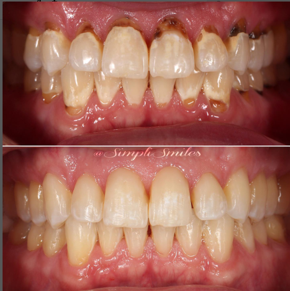 teeth image teeth image