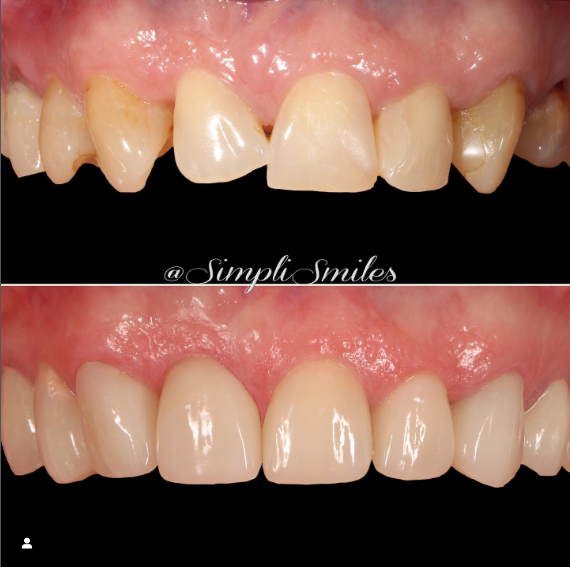 teeth image teeth image