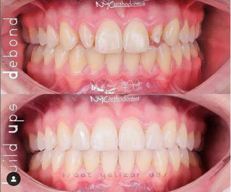 teeth image teeth image