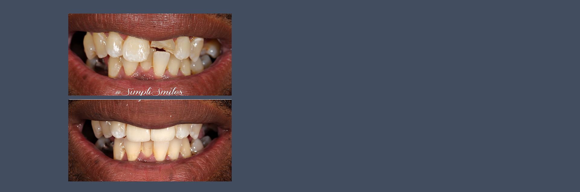 Los Angeles Los Angeles